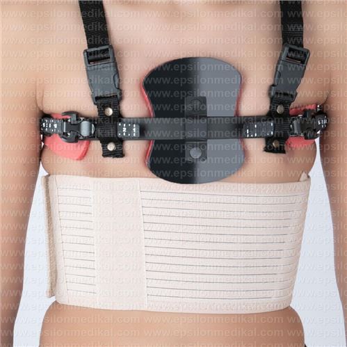 PECTUS CARİNATUM ORTEZ ( GÜVERCİN GÖĞSÜ KORSE)